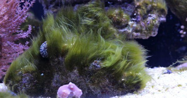 Saç Yosunu Nedir? Tedavi Yöntemleri Nelerdir?